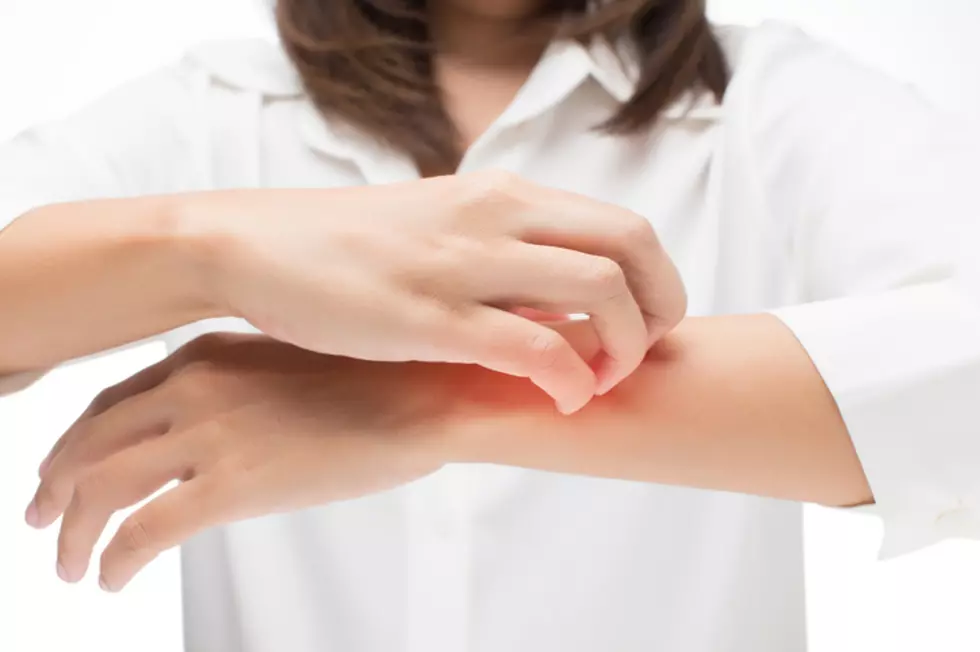 806 Health Tip: Mosquitoes Really Seem To Love You